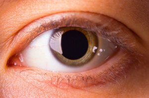 Supplements with Q10 and other antioxidants for common eye diseases
