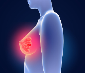 Cancro da mama: Os níveis de selénio no sangue permitem prever uma sobrevida a 10 anos